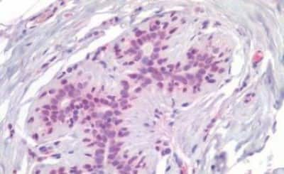 Immunohistochemistry-Paraffin: RUNX1/CBFA2 Antibody [NBP3-14464]